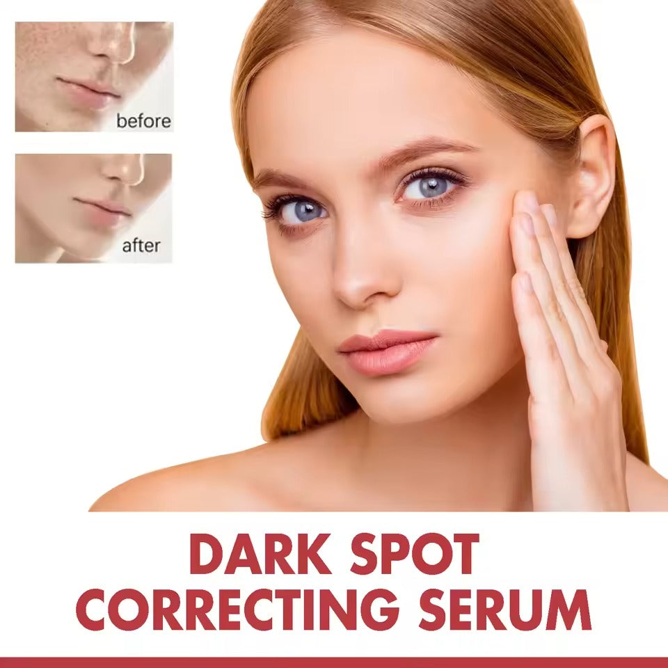 Dark Spot Repair Serum – Fades Pigmentation & Age Spots, Brightens Skin